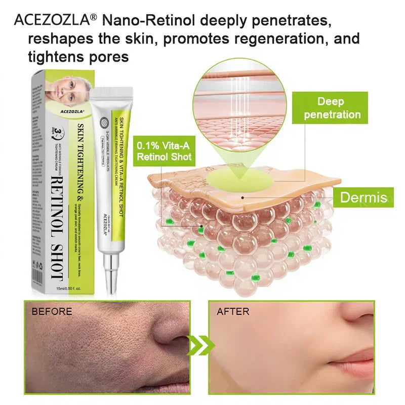 ✨Final 3 Hours: 70%OFF🔥Acezozla™ Botulinum & Vita-A Retinol Shot Wrinkle-Lift Tightening cream✨