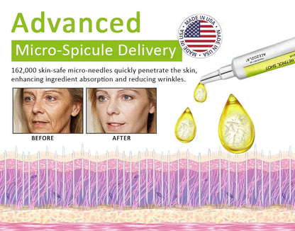 ✨Final 3 Hours: 70%OFF🔥Acezozla™ Botulinum & Vita-A Retinol Shot Wrinkle-Lift Tightening cream✨